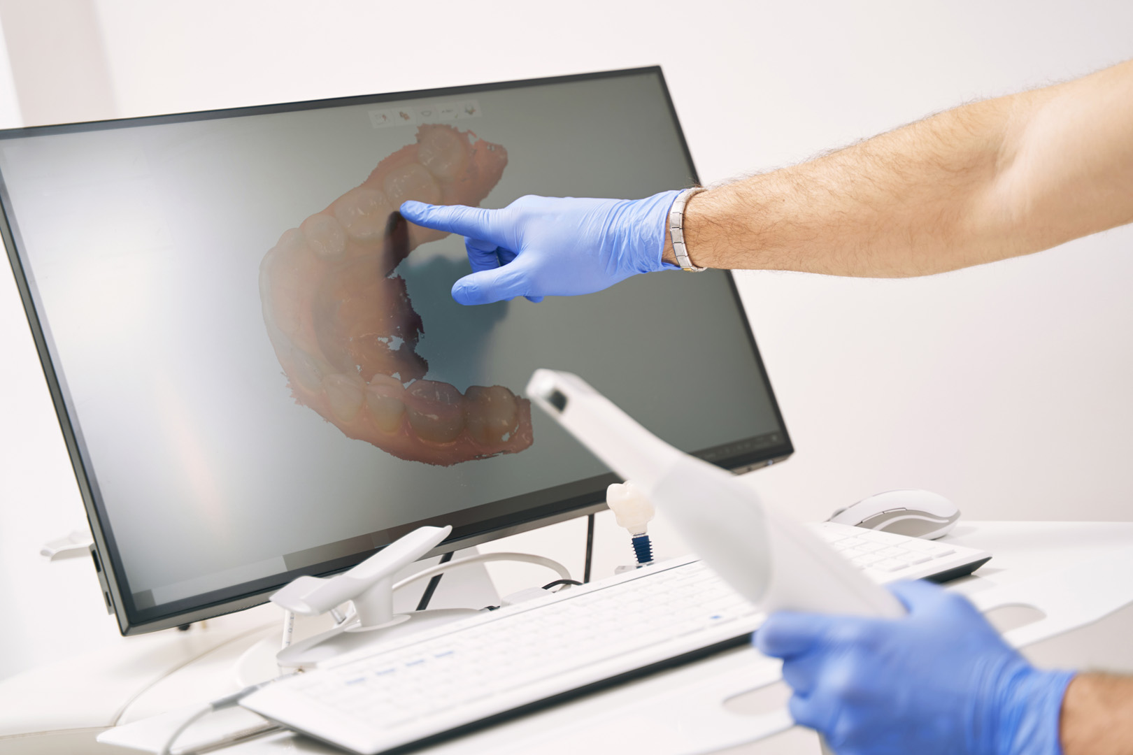 Close up of dental 3D digital scanning device being used on a patient