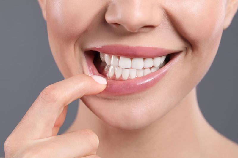 Professional dental cleaning and periodontal maintenance in Honolulu